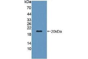 Detection of Recombinant PZP, Human using Polyclonal Antibody to Pregnancy Zone Protein (PZP) (PZP Antikörper  (AA 1212-1391))