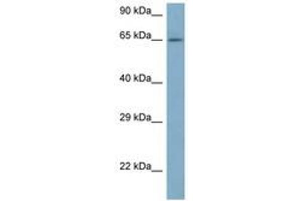 ARFGAP3 Antikörper  (AA 91-140)