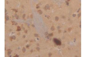 Detection of CK18 in Mouse Cerebrum Tissue using Polyclonal Antibody to Cytokeratin 18 (CK18) (Cytokeratin 18 Antikörper  (AA 1-423))