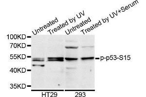 Western blot analysis of extracts of HT-29 cell line, using Phospho-p53-S15 antibody. (p53 Antikörper  (pSer15))