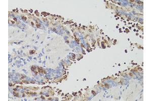 Immunohistochemistry of paraffin-embedded mouse bronchial epithelium using PDCD1 antibody (ABIN6290170) at dilution of 1:200 (40x lens). (PD-1 Antikörper)