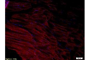 Formalin-fixed and paraffin-embedded rat tongue labeled with Anti-ADAMTS1 Polyclonal Antibody, Unconjugated (ABIN673404) 1:200, overnight at 4°C, The secondary antibody was Goat Anti-Rabbit IgG, Cy3 conjugated used at 1:200 dilution for 40 minutes at 37°C. (ADAMTS1 Antikörper  (AA 851-967))