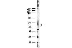 anti-serine/threonine Kinase 17b (STK17B) (C-Term) antibody