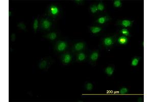 Immunofluorescence of monoclonal antibody to CSE1L on HeLa cell. (Exportin 2 Antikörper  (AA 872-971))