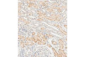 Immunohistochemical analysis of paraffin-embedded human kidney tissue using  performed on the Leica® BOND RXm. (LZIC Antikörper  (AA 81-109))
