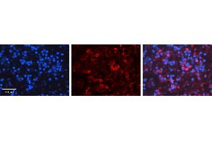 Rabbit Anti-PRKCD Antibody Catalog Number: ARP56701_P050 Formalin Fixed Paraffin Embedded Tissue: Human Lymph Node Tissue Observed Staining: Cytoplasm Primary Antibody Concentration: 1:600 Other Working Concentrations: N/A Secondary Antibody: Donkey anti-Rabbit-Cy3 Secondary Antibody Concentration: 1:200 Magnification: 20X Exposure Time: 0.