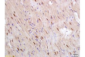 Formalin-fixed and paraffin embedded rat heart labeled with Anti Glucagon Receptor Polyclonal Antibody, Unconjugated (ABIN751528) followed by conjugation to the secondary antibody and DAB staining (Glucagon Receptor Antikörper  (AA 11-110))