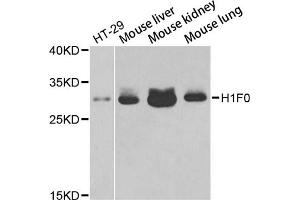 Western blot analysis of extracts of various cell lines, using H1F0 antibody (ABIN5971687) at 1/1000 dilution. (Histone H1 Antikörper)
