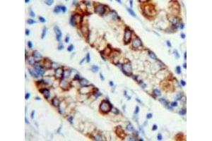 Used in DAB staining on fromalin fixed paraffin-embedded Stomach tissue (MPL Antikörper  (AA 311-460))