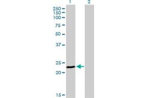 Western Blot analysis of FXN expression in transfected 293T cell line by FXN monoclonal antibody (M03), clone 3G9.