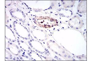 Fig. (MCAM Antikörper  (AA 84-189))