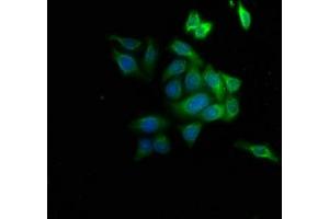 Immunofluorescence staining of HepG2 cells with ABIN7143311 at 1:133, counter-stained with DAPI. (AHCY Antikörper  (AA 2-432))