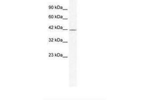 Image no. 1 for anti-gamma-aminobutyric Acid (GABA) A Receptor, alpha 3 (GABRA3) (AA 217-266) antibody (ABIN202653) (GABRA3 Antikörper  (AA 217-266))