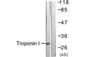 Western Blotting (WB) image for anti-Cardiac Troponin I (TNNI3) (AA 11-60) antibody (ABIN2888778) (TNNI3 Antikörper  (AA 11-60))