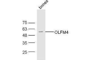 Olfactomedin 4 Antikörper  (AA 111-510)