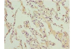 Immunohistochemistry of paraffin-embedded human lung tissue using ABIN7150982 at dilution of 1:100 (ARIH2 Antikörper  (AA 194-493))