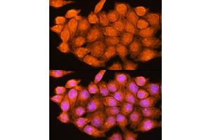 Immunofluorescence (IF) image for anti-Adenosine Kinase (ADK) (AA 200-345) antibody (ABIN7265462)