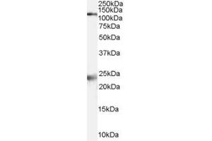 Western Blotting (WB) image for anti-Glutamate Receptor, Ionotropic, N-Methyl D-Aspartate 1 (GRIN1) (AA 486-497) antibody (ABIN295141)
