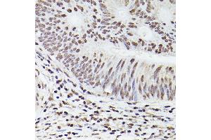 Immunohistochemistry (IHC) image for anti-Ionized Calcium-binding Adapter Molecule 1 (IBA1) (AA 1-147) antibody (ABIN6136676)