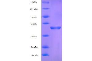 SDS-PAGE (SDS) image for Coagulation Factor V (F5) (AA 1490-1614), (partial) protein (His-SUMO Tag) (ABIN5709491)
