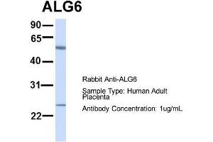 Host:  Rabbit  Target Name:  ALG6  Sample Type:  Human Adult Placenta  Antibody Dilution:  1.