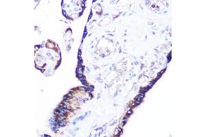 Immunohistochemistry of paraffin-embedded human placenta using RRAGA Rabbit pAb (ABIN7269878) at dilution of 1:100 (40x lens). (RRAGA Antikörper  (AA 1-160))