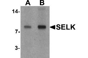 Western blot analysis of SELK in A20 cell lysate with SELK antibody at (A) 1 and (B) 2 µg/mL. (Selenoprotein K Antikörper  (C-Term))
