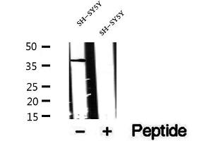 Western blot analysis of extracts of SH-SY5Y cells, using CXXC5 antibody.