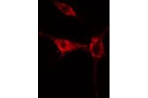 ABIN6275467 staining  HuvEc cells by IF/ICC. (RAB37 Antikörper  (C-Term))