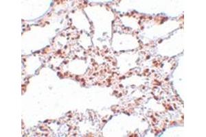 Immunohistochemical staining of rat lung tissue with ZSCAN4 polyclonal antibody  at 5 ug/mL dilution.
