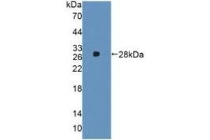 alpha 2 Macroglobulin Antikörper  (AA 616-856)