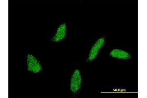 Immunofluorescence of monoclonal antibody to UBE2U on HeLa cell. (UBE2U Antikörper  (AA 9-102))