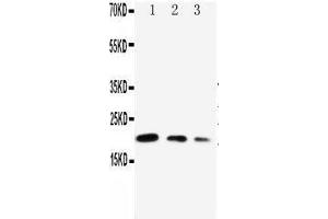 Anti-CDC42 antibody, Western blotting Lane 1: Recombinant Human CDC42 Protein 10ng Lane 2: Recombinant Human CDC42 Protein 5ng Lane 3: Recombinant Human CDC42 Protein 2. (CDC42 Antikörper  (Middle Region))