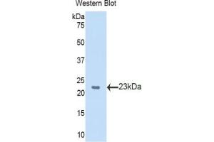 Western blot analysis of the recombinant protein. (SLIT2 Antikörper  (AA 31-197))