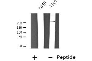 Western blot analysis of extracts from A549 cells, using CACNA1H antibody. (CACNA1H Antikörper  (Internal Region))