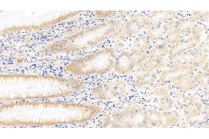 Detection of Surv in Human Stomach Tissue using Polyclonal Antibody to Survivin (Surv) (Survivin Antikörper  (AA 1-142))