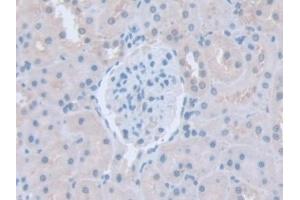 Detection of ITSN1 in Rat Kidney Tissue using Polyclonal Antibody to Intersectin 1 (ITSN1) (ITSN1 Antikörper  (AA 1-227))