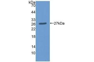 Detection of Recombinant ME2, Human using Polyclonal Antibody to Malic Enzyme 2, NADP+ Dependent, Mitochondrial (ME2) (Malic Enzyme 2, NADP+ Dependent, Mitochondrial (AA 220-426) Antikörper)
