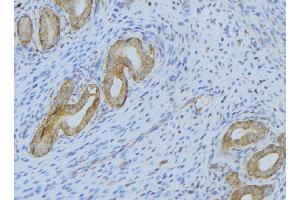 ABIN6275364 at 1/100 staining Human uterus tissue by IHC-P. (SERPING1 Antikörper  (Internal Region))
