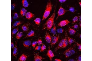 IF analysis of MTUS1 using anti-MTUS1 antibody (ABIN6719607). (MTUS1 Antikörper  (AA 1038-1236))