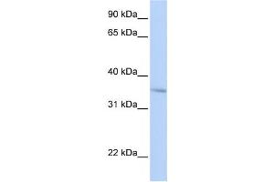 Western Blotting (WB) image for anti-Four and A Half LIM Domains 3 (FHL3) antibody (ABIN2459421) (FHL3 Antikörper)