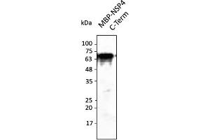 Western Blotting (WB) image for anti-SARS-CoV-2 Non-Structural Protein 4 (NSP4) (C-Term) antibody (ABIN7272999) (SARS-CoV-2 NSP4 Antikörper  (C-Term))