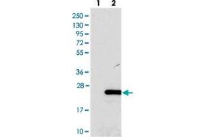 Western blot analysis of Lane 1: Negative control (vector only transfected HEK293T lysate), Lane 2: Over-expression Lysate (Co-expressed with a C-terminal myc-DDK tag (~3. (FOPNL Antikörper)