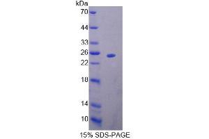 SDS-PAGE analysis of Mouse MTF1 Protein. (MTF1 Protein)