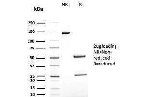 SDS-PAGE Analysis Purified TAG-72 Recombinant Mouse Monoclonal Antibody (rB72. (Rekombinanter TAG-72 / CA72.4 Antikörper)