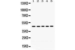 Anti- PGK1 Picoband antibody, Western blottingAll lanes: Anti PGK1  at 0. (PGK1 Antikörper  (C-Term))