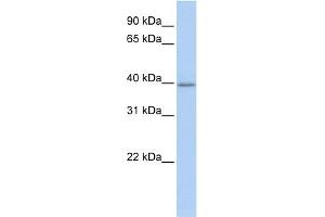 Western Blotting (WB) image for anti-Thioredoxin Interacting Protein (TXNIP) (C-Term) antibody (ABIN2784817)