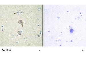 Immunohistochemistry analysis of paraffin-embedded human brain tissue, using NKTR polyclonal antibody . (NKTR Antikörper)
