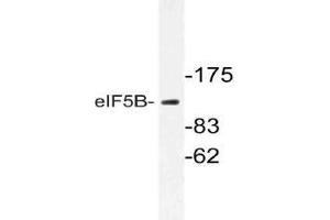 Western blot (WB) analysis of eIF5B antibody in extracts from Jurkat cells. (EIF5B Antikörper)
