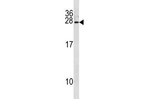 Western Blotting (WB) image for anti-Interferon, alpha 8 (IFNA8) antibody (ABIN3004546) (IFNA8 Antikörper)